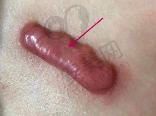 总结