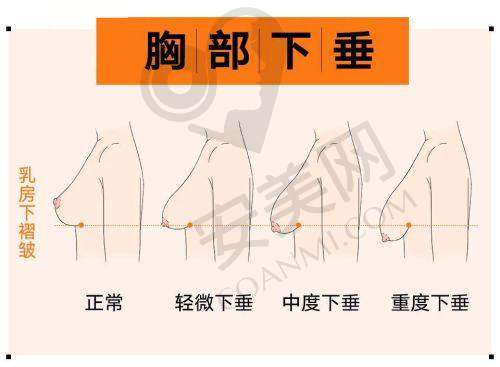 热玛吉抗衰：神奇的逆龄魔法