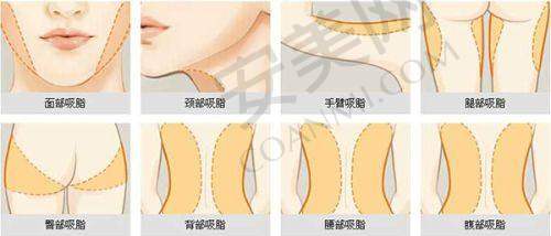 价格体系：武汉美莱和艺星哪个更具性价比？