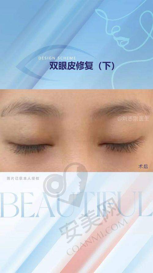 制定修复方案：有哪些独特之处？