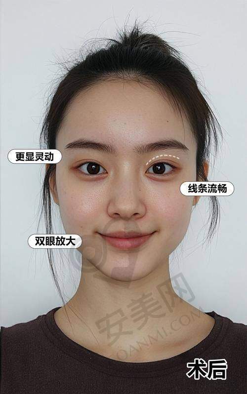 总结