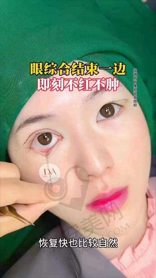 专精团队，为眼综合手术保驾护航