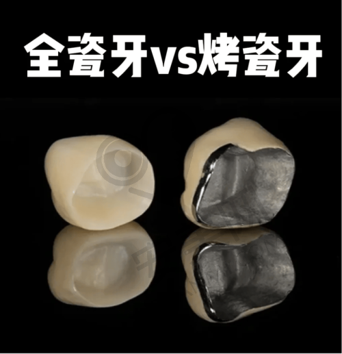 长沙好大夫口腔全瓷牙冠修复技术有哪些特色？