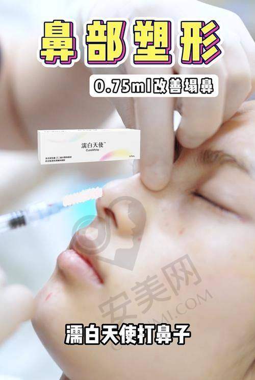 顾客在进行面部微整注射前需要注意什么？