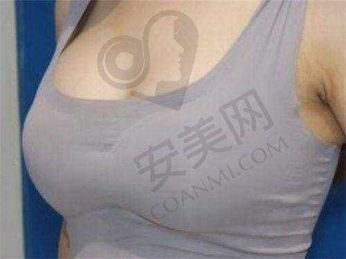 李献和与赵延峰的技术风格有何不同?