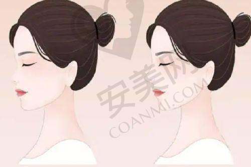 3、常德寇妍杜克祥医生整形技术怎么样？