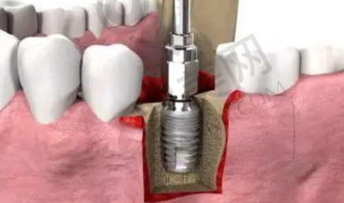 3、金华莱蒽口腔冷雄医生（诊疗项目）收费价格：