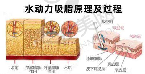 薛艳峰医生预约挂号指南
