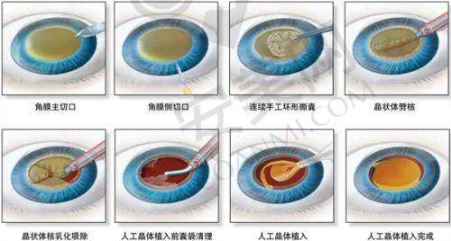 赵延峰医生的口碑好不好?