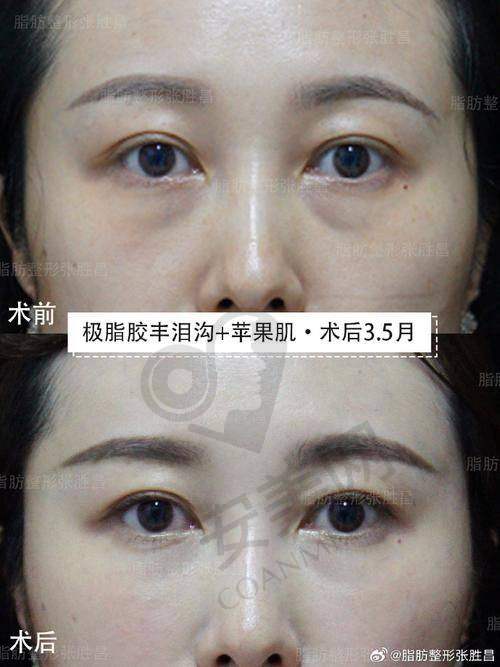 5、成都艾米丽张良玉医生患者评价