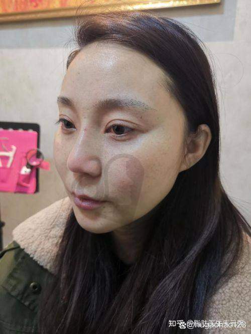 2、成都艾米丽张良玉医生擅长项目：