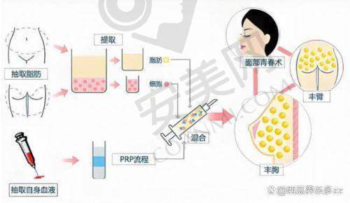 3、成都艾米丽张良玉医生整形技术怎么样？