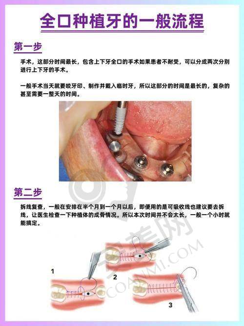 术前准备：了解注意事项