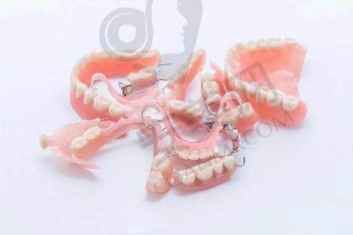 选择建议：根据需求匹配项目