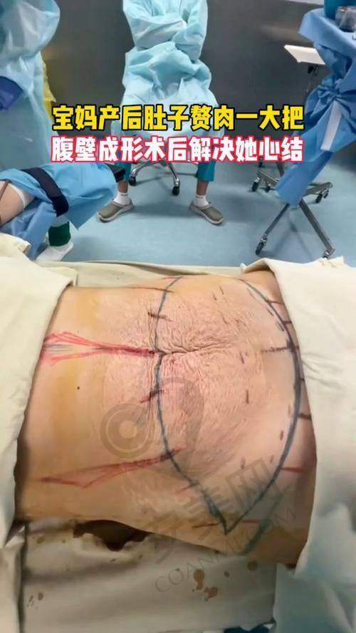 众多求美者高满意度背后的秘诀是什么?