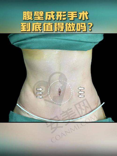 选择成都现代整形医院和李献和医生的理由