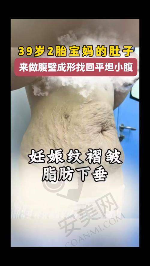 手术过程是怎样的？会不会特别痛苦？