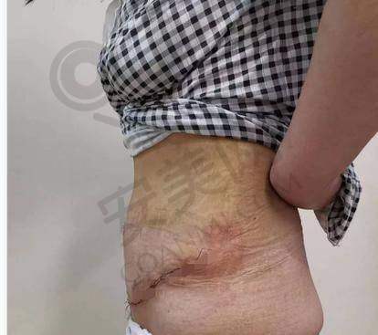 诊疗成效如何？我的感受是怎样的？