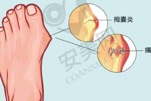 口周年轻化治疗后需要注意什么？