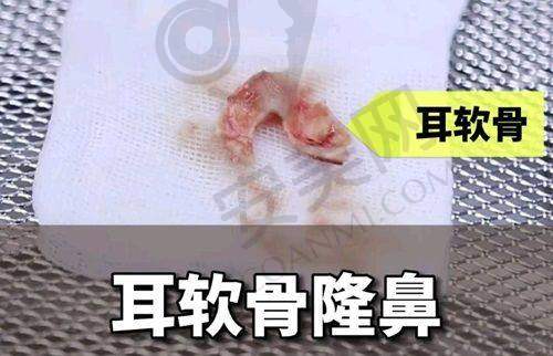 厦门美莱医疗美容医院:规模与实力并存的大型机构