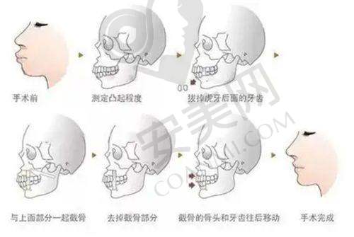 专精医美资质体现在哪些方面？全方面解读医院实力