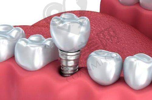 福州登特口腔医院：优质的诊疗体验