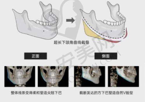 上海九院整形外科好医生名单