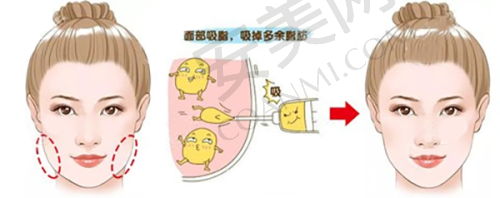 2、徐州医 科汇美付晓医生擅长项目: