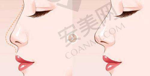 合肥华美：专精医美机构的保护