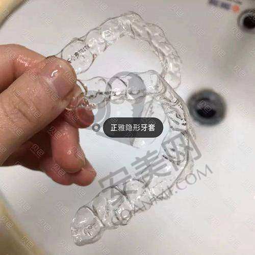 正雅隐形矫正悦享版9999元起的价格优势在哪里？