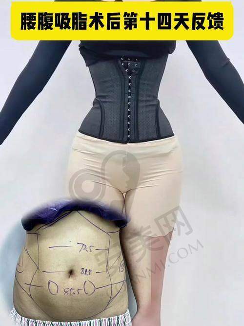 患者的真实反馈如何？