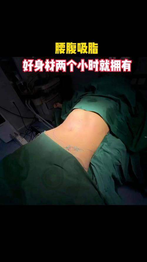腰腹环吸手术有哪些注意事项？