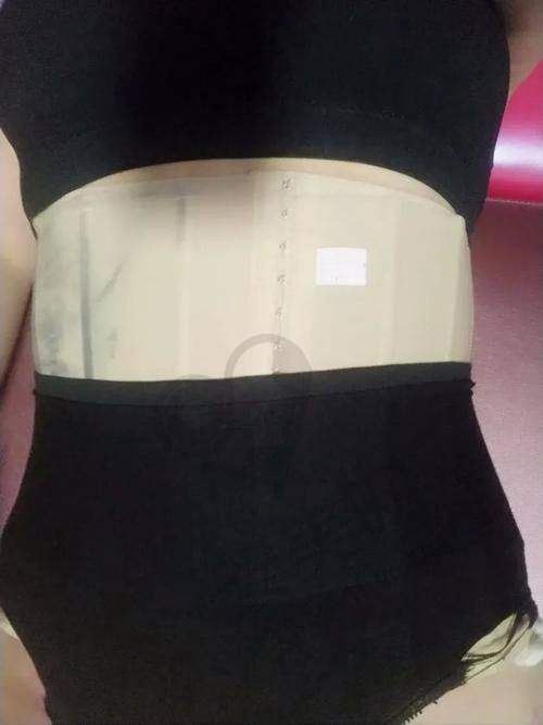 什么是腰腹环吸？