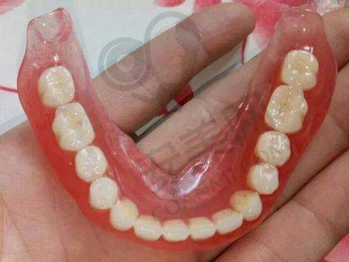 云南玉溪舒尔口腔门诊部的种植牙项目怎么样?