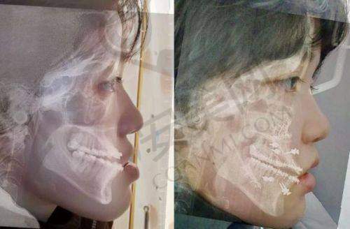 济南海峡整形医院的实力体现在哪些方面?