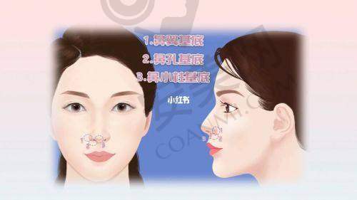 注射后的修复情况和成效如何?