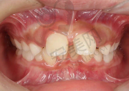 六、重庆名博士口腔门诊部预约挂号流程: