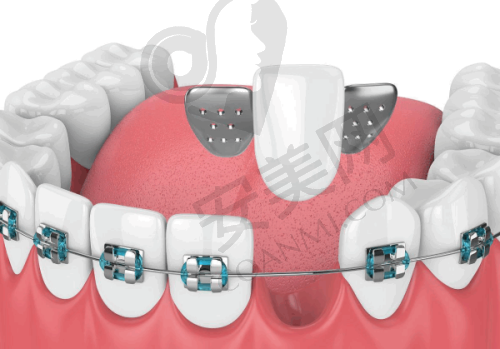总结:性价比高的选择
