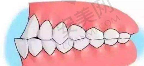 南京金铂利口腔医院牙齿矫正的初诊是怎样的？