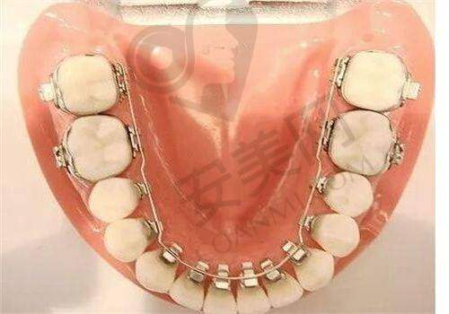 南京金铂利口腔医院牙齿矫正技术有什么特色？