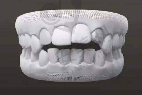 南京金铂利口腔医院牙齿矫正的诊疗成效如何？