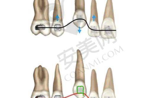 在南京金铂利口腔医院牙齿矫正的感受如何？