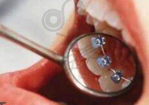 泰州种植牙价格及推荐医院