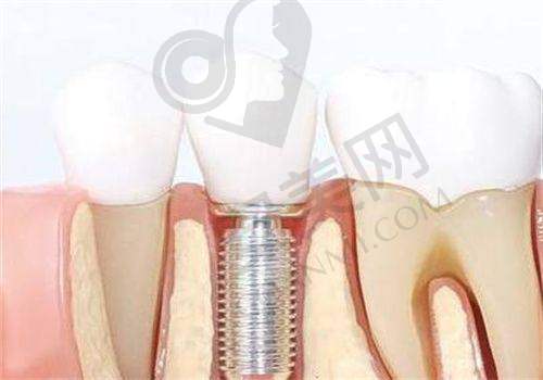 3、仙桃源博士口腔陈亮医生诊疗项目收费价格