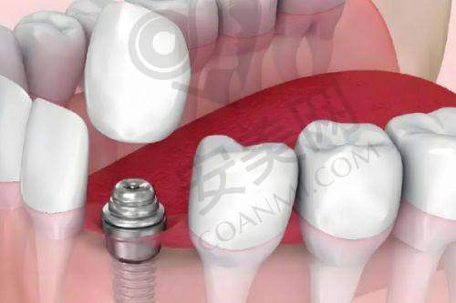 6、乌鲁木齐天使口腔杜旺医生预约挂号指南