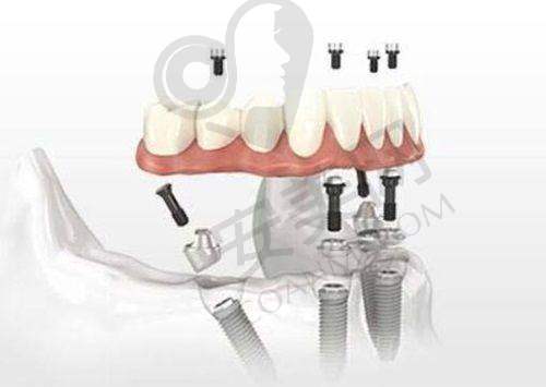 6、重庆名博士口腔门诊部叶金平医生预约挂号指南