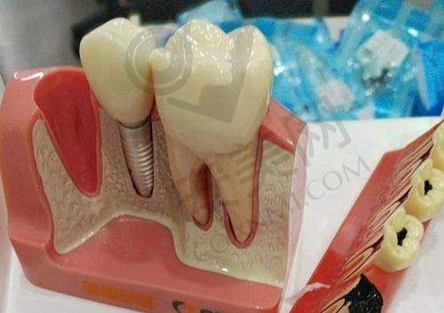 5、大连齿医生口腔徐奥翔医生患者评价: