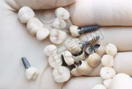 5、重庆名博士口腔门诊部叶金平医生患者评价: