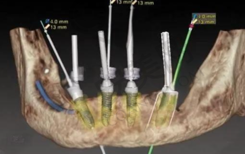 6、仙桃源博士口腔陈亮医生预约挂号指南