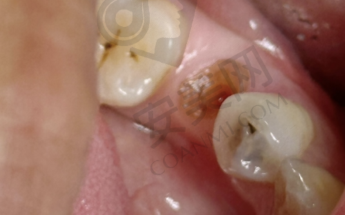 4、大连齿医生口腔徐奥翔医生社会职称: